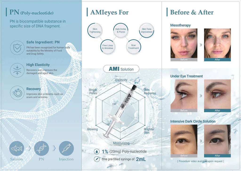 AMI EYES FillerNew.com 