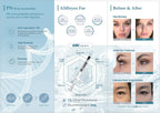 AMI EYES FillerNew.com 